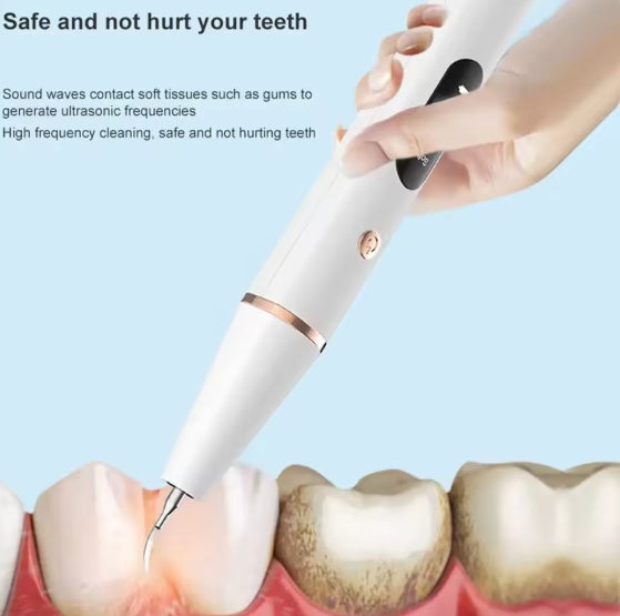 Smart Ultra-Sonic Teeth Cleaner
